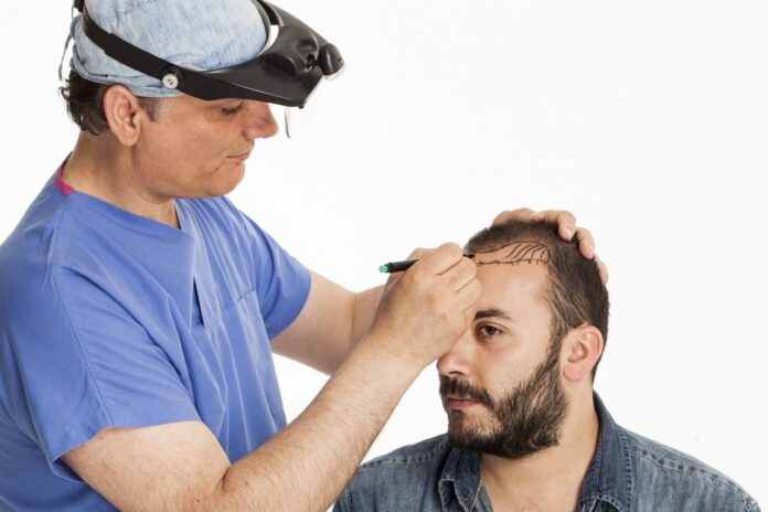 زراعة الشعر في دبي