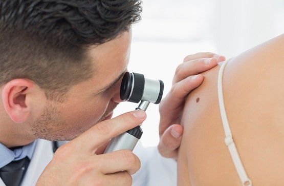 skin cancer clinic Sydney CBD