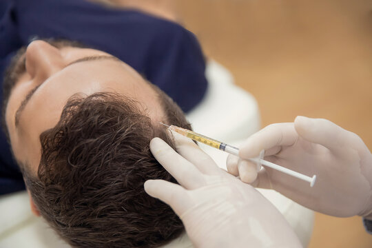 PRP Hair Treatment in Riyadh