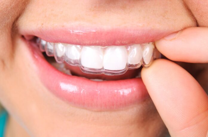 cheap invisalign in Nampa