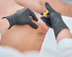 Fat melting injections